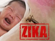 اپیدمی جهانی میکروسفالی ناشی از ویروس زیکا در راه است