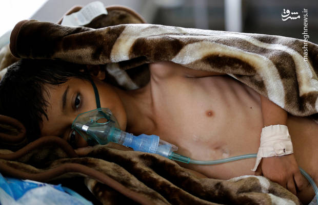 قتل عام هزاران کودک یمنی در سکوت مجامع جهانی/ جنگ خاموش عربستان و آمریکا در یمن/ اینجا هر ۳۵ ثانیه یک کودک «وبا» می‌گیرد! +عکس(۱۶+)